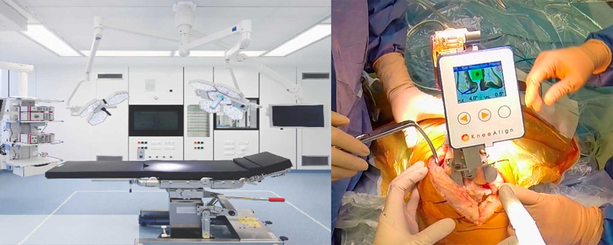 Hitech-Operation-Theatre-&-Navigation-System-for-Precise-Alignment-in-Joint-Replacement-Surgeries
