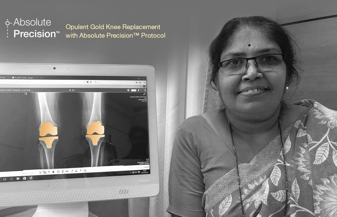 Patient-Feedback-After-Opulent-Bionik-Gold-Knee-Replacement-Mumbai