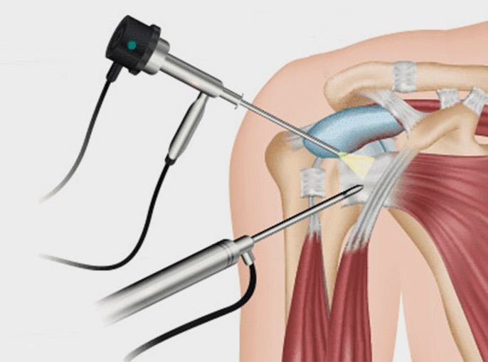 Arthroscopy Centre Mumbai