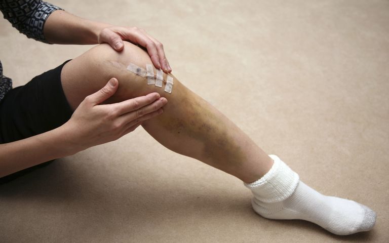 minimal inavasive knee replacement